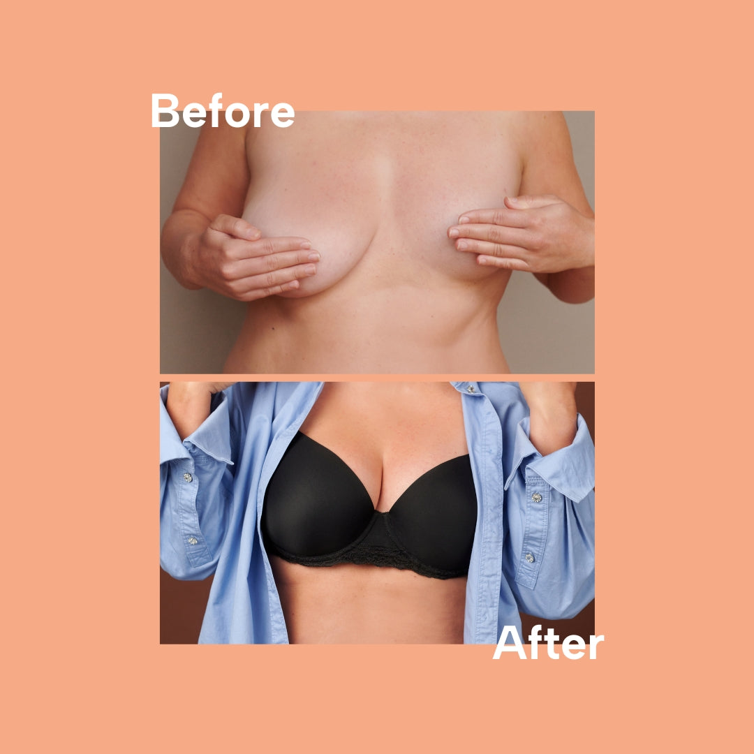 Signature Bra - bra for uneven breasts
