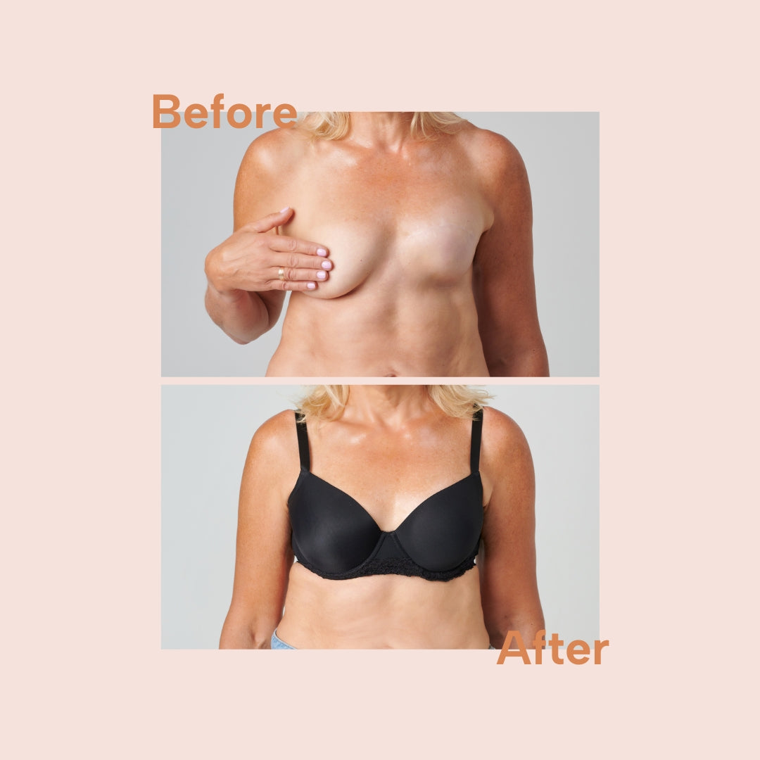 Signature Bra - bra for uneven breasts