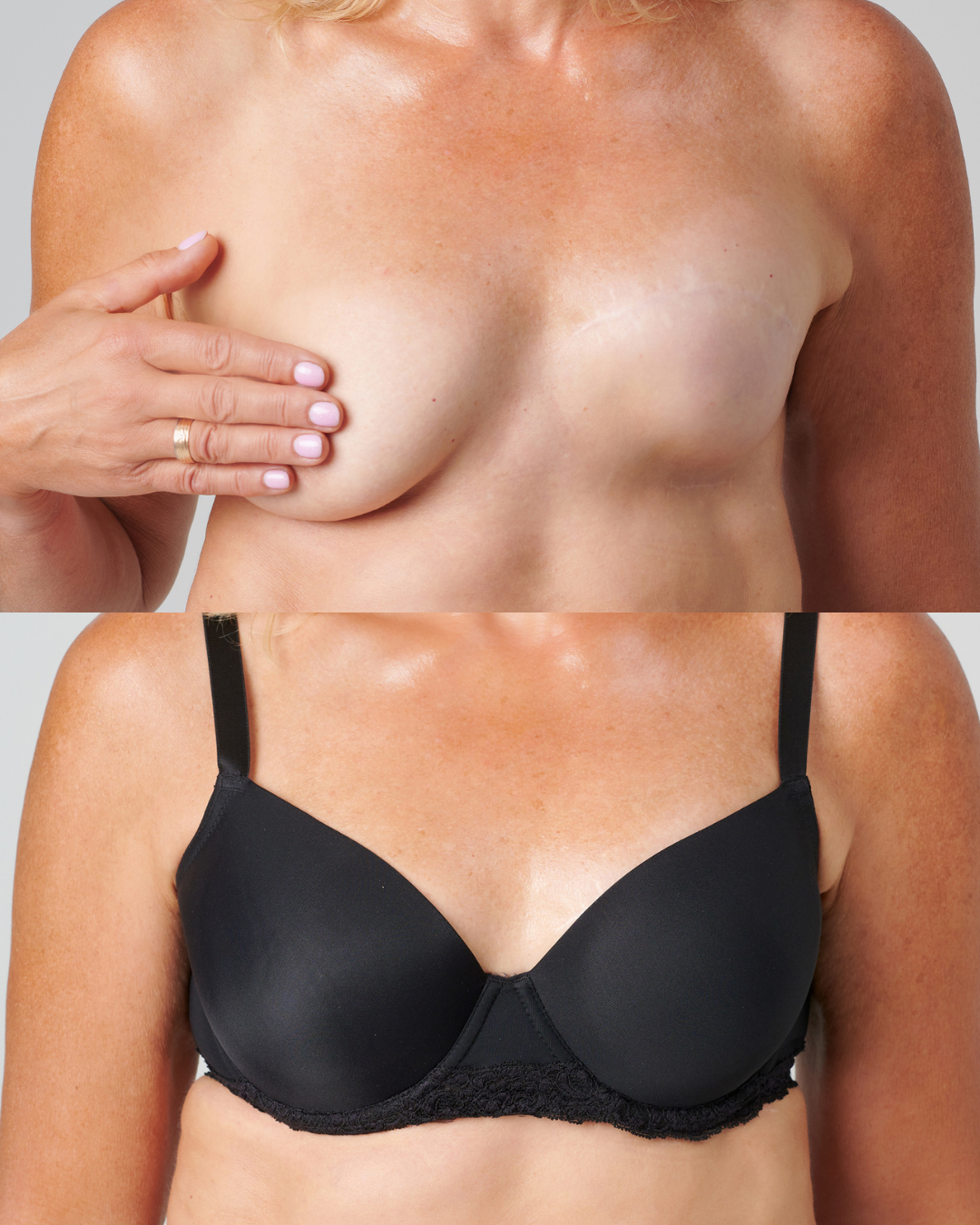 Signature Bra - bra for uneven breasts