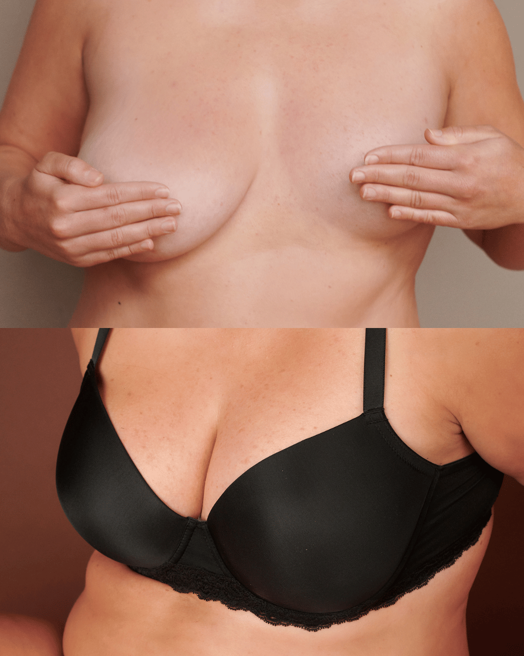Symm B&A1.png__PID:dafc1bff-0e4a-4701-85e7-45cc2a409cdb